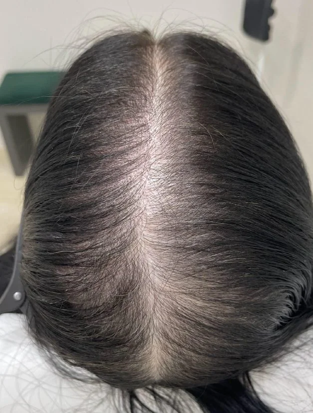 Resultado 2: antes
