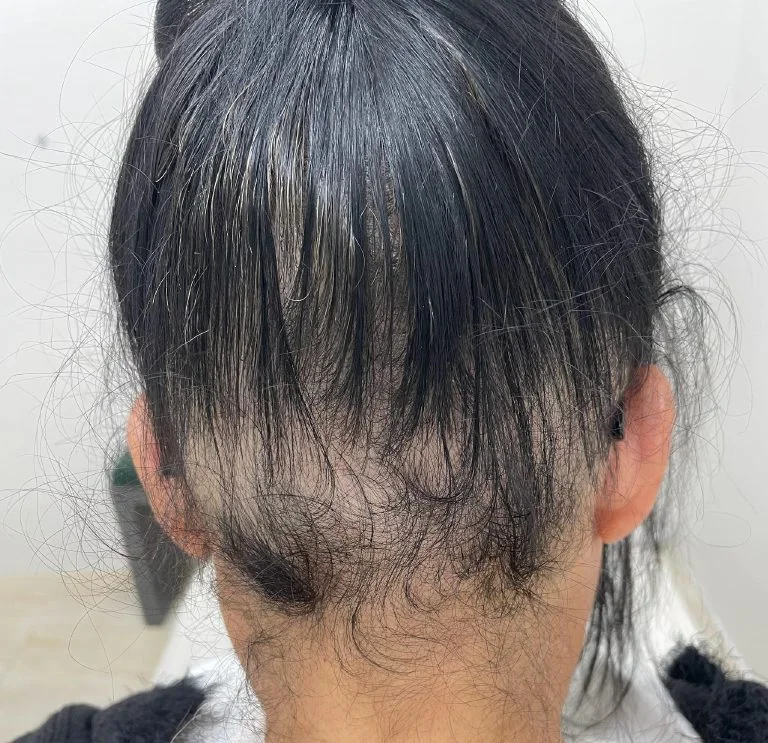 Resultado 6: antes