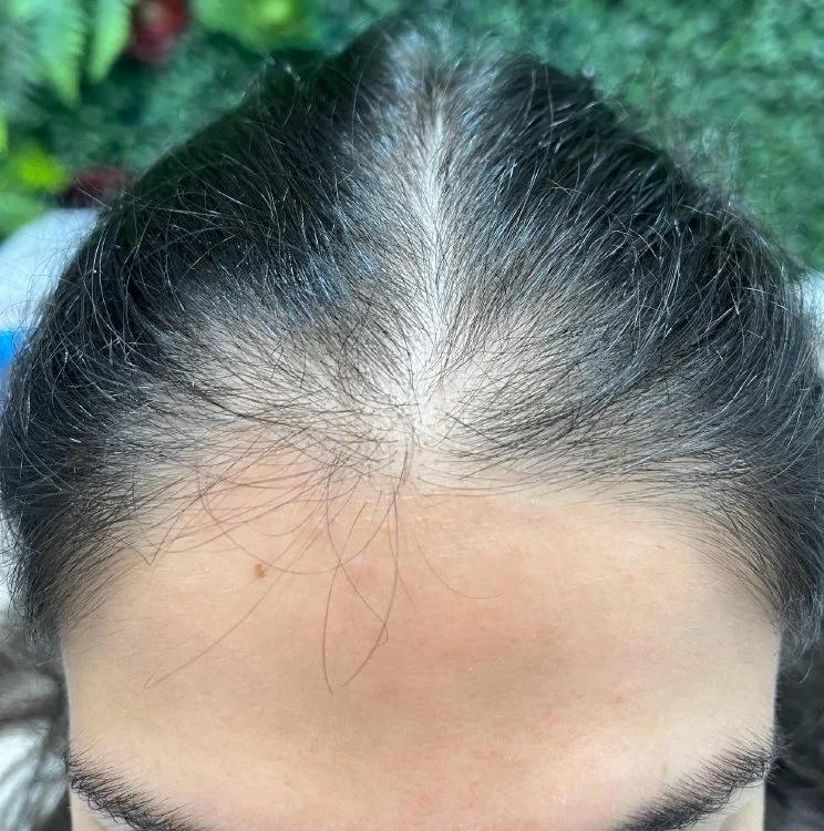 Resultado 8: antes