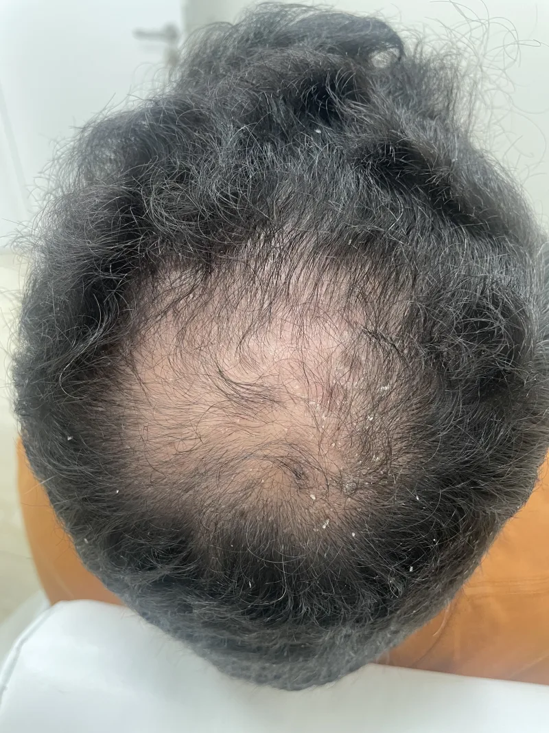 Resultado 9: antes